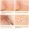 にきびケアキット角栓毛穴汚れステンレス美肌BESTOPEBlackheadRemoverPimpleComedoneExtractorToolBestAcneRemovalKit-TreatmentforBlemish,WhiteheadPopping,ZitRemovingforRiskFreeNoseFaceSkinwithMetalCase